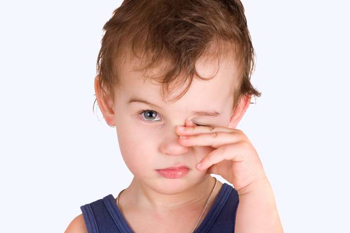 Покраснение и шелушение кожи вокруг глаз у ребенка