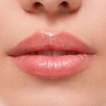 Увеличение губ филлерами: отзывы, достоинства и недостатки