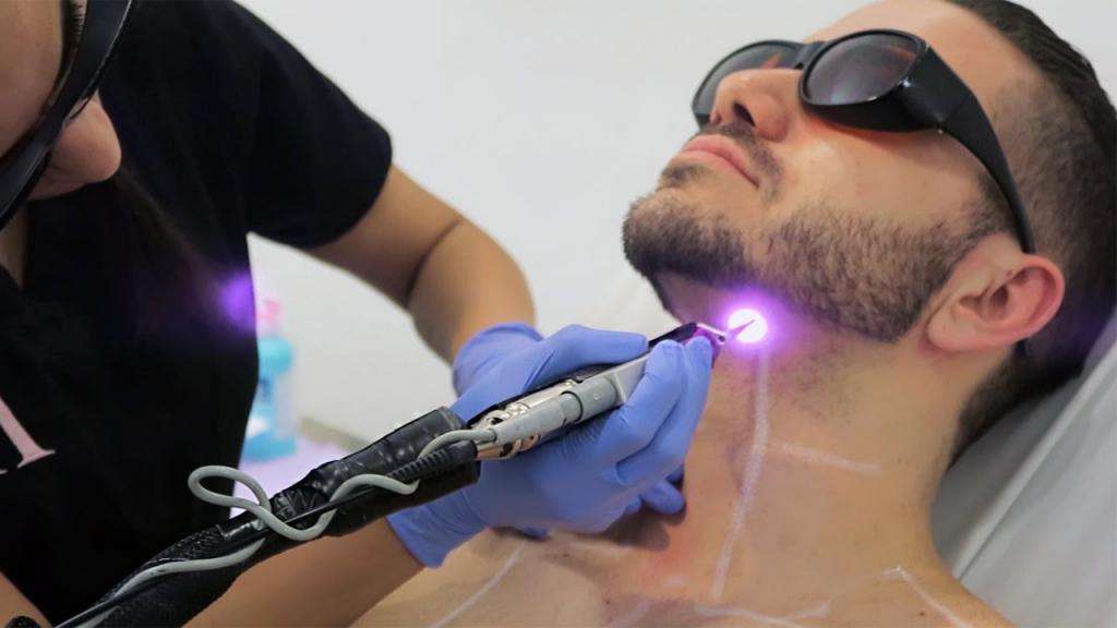 александровский лазер для удаления волос отзывы